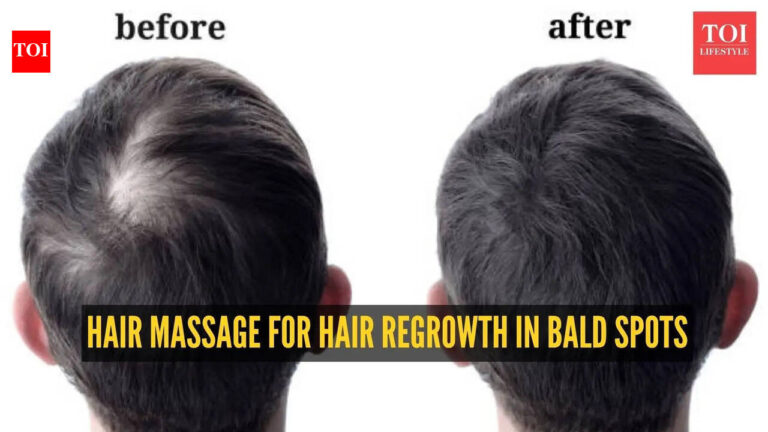 Scalp Massage For Hair Regrowth: Hair regrowth: How to do the best scalp massage for hair regrowth in bald spots